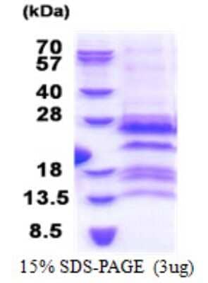 SDS-PAGE: Recombinant Human G antigen 12F His Protein [NBP2-23065]