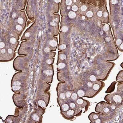 Immunohistochemistry-Paraffin: G gamma12 Antibody [NBP2-38953]