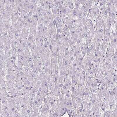 Immunohistochemistry-Paraffin: G gamma12 Antibody [NBP2-38953]