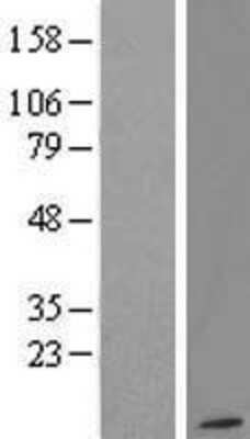 Western Blot: G gamma12 Overexpression Lysate [NBL1-11172]