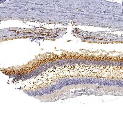 Immunohistochemistry-Paraffin: G gamma14 Antibody [NBP2-58646]