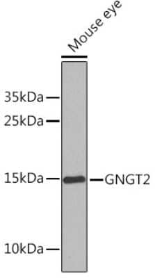 Western Blot: G gamma14 AntibodyBSA Free [NBP3-03502]