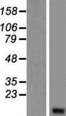 Western Blot: G gamma14 Overexpression Lysate [NBP2-06120]