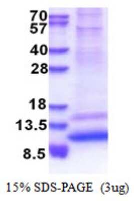 SDS-PAGE: Recombinant Human G gamma4 His Protein [NBP2-51535]