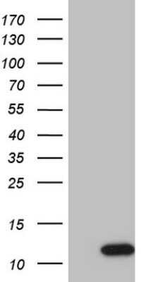 Western Blot: G gamma7 Antibody (OTI3G1)Azide and BSA Free [NBP2-70838]