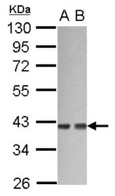 Western Blot: G protein alpha 12 Antibody [NBP2-16556]