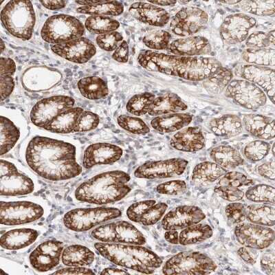 Immunohistochemistry-Paraffin: G protein alpha-13 Antibody [NBP1-89810]