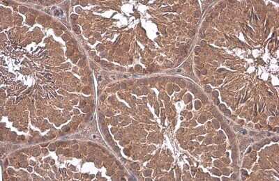 Immunohistochemistry-Paraffin: G protein alpha-13 Antibody [NBP3-12983]