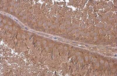 Immunohistochemistry-Paraffin: G protein alpha-13 Antibody [NBP3-12983]