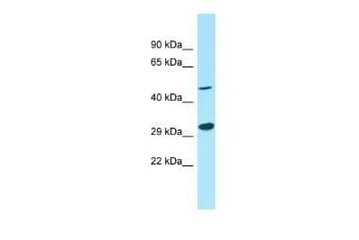 Western Blot: G protein alpha-13 Antibody [NBP2-87477]