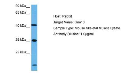 Western Blot: G protein alpha-13 Antibody [NBP2-87477]