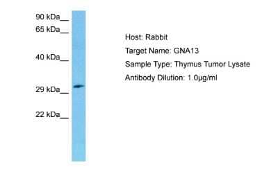 Western Blot: G protein alpha-13 Antibody [NBP2-87479]