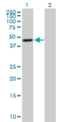 Western Blot: G protein alpha 16 Antibody [H00002769-B01P]