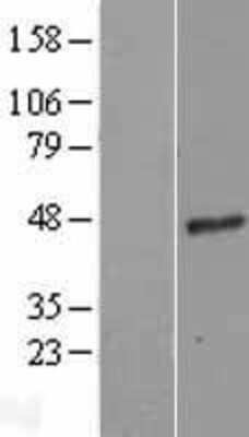 Western Blot: G protein alpha 16 Overexpression Lysate [NBL1-11154]