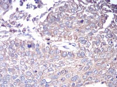 Immunohistochemistry: G protein alpha Antibody (2A2B7) - BSA Free [NBP2-52477]