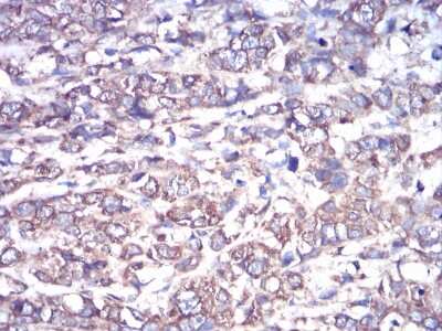 Immunohistochemistry: G protein alpha Antibody (2A2B7) - BSA Free [NBP2-52477]
