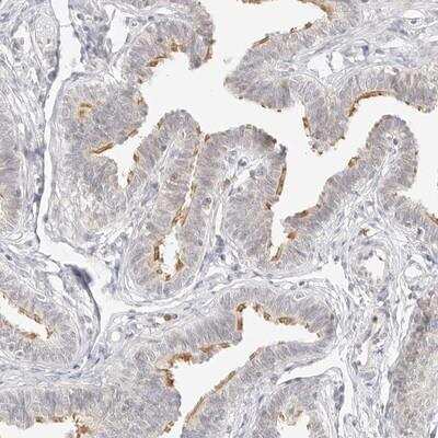 Immunohistochemistry: G protein alpha Antibody [NBP1-89752]