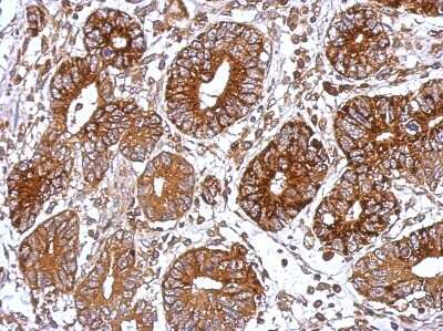 Immunohistochemistry-Paraffin: G protein alpha Antibody [NBP1-31730]