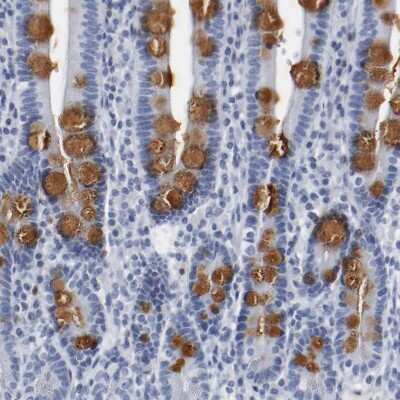 Immunohistochemistry-Paraffin: G protein alpha Antibody [NBP1-89754]
