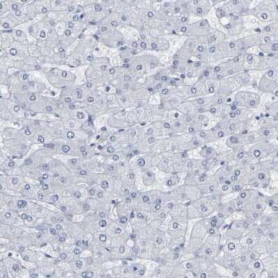 Immunohistochemistry-Paraffin: G protein alpha Antibody [NBP1-89754]