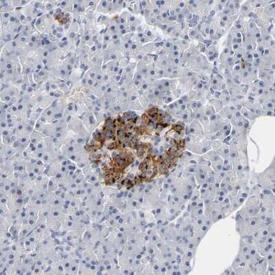 Immunohistochemistry-Paraffin: G protein alpha Antibody [NBP1-89754]