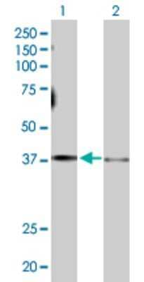 Western Blot: G protein alpha Antibody [H00002778-D01P]