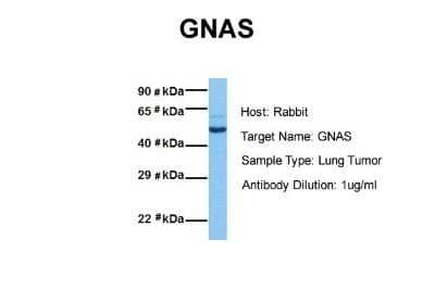 Western Blot: G protein alpha Antibody [NBP1-58349]