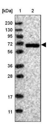 Western Blot: G protein alpha Antibody [NBP1-89753]