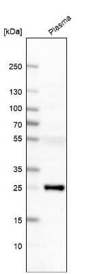 Western Blot: G protein alpha Antibody [NBP1-89754]