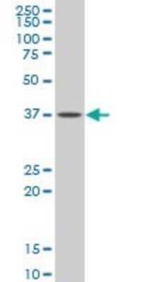 Western Blot: G protein alpha Inhibitor 2 Antibody (2E4) [H00002771-M03]