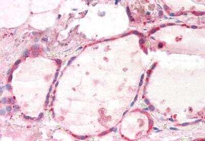 Immunohistochemistry-Paraffin: G protein alpha Inhibitor 2 Antibody [NBP2-44318]