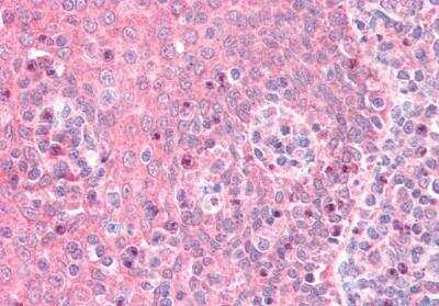 Immunohistochemistry-Paraffin: G protein alpha Inhibitor 2 Antibody [NBP2-44318]