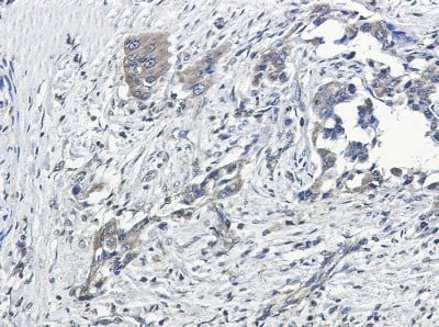 Immunohistochemistry-Paraffin: G protein alpha Inhibitor 2 Antibody (S05-7I1) [NBP3-19868]