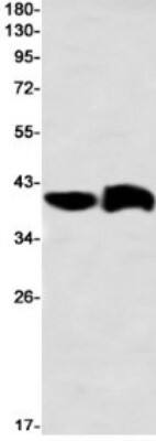 Western Blot: G protein alpha Inhibitor 2 Antibody (S05-7I1) [NBP3-19868]