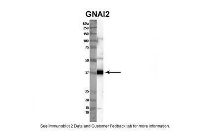 Western Blot: G protein alpha Inhibitor 2 Antibody [NBP1-58301]