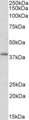 Western Blot: G protein alpha Inhibitor 2 Antibody [NBP2-44318]