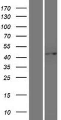 Western Blot: G protein alpha Overexpression Lysate [NBP2-05782]