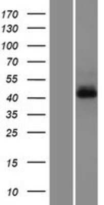 Western Blot: G protein alpha Overexpression Lysate [NBP2-10677]