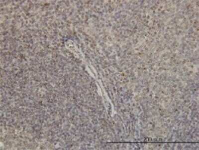 Immunohistochemistry-Paraffin: G protein alpha inhibitor 1 Antibody (2B8-2A5) [H00002770-M01]
