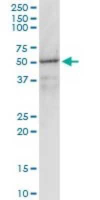 Western Blot: G protein alpha inhibitor 1 Antibody (2B8-2A5) [H00002770-M01]