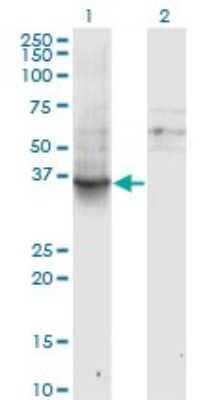 Western Blot: G protein alpha inhibitor 1 Antibody (2B8-2A5) [H00002770-M01]