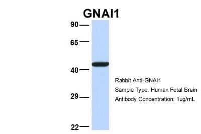 Western Blot: G protein alpha inhibitor 1 Antibody [NBP1-52926]