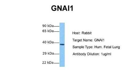 Western Blot: G protein alpha inhibitor 1 Antibody [NBP1-52926]