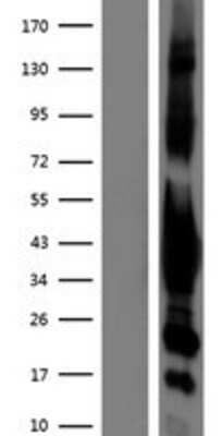 Western Blot: G protein alpha inhibitor 1 Overexpression Lysate [NBP2-10798]