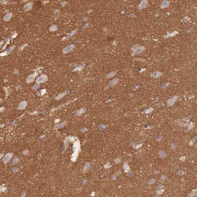 Immunohistochemistry-Paraffin: G protein beta 4 Antibody [NBP2-14060]
