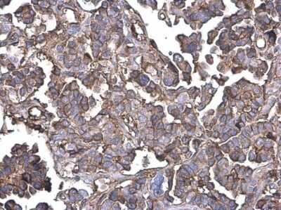 Immunohistochemistry-Paraffin: G protein beta 4 Antibody [NBP3-13295]