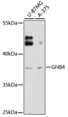 Western Blot: G protein beta 4 AntibodyAzide and BSA Free [NBP3-03459]