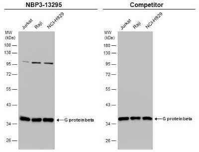 Western Blot: G protein beta 4 Antibody [NBP3-13295]