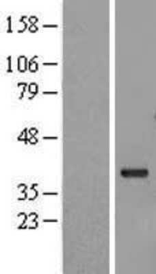 Western Blot: GBL Overexpression Lysate [NBL1-10995]