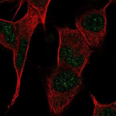 Immunocytochemistry/ Immunofluorescence: G-substrate Antibody [NBP2-68949]